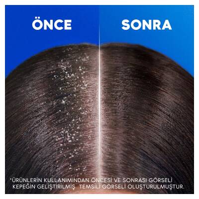 Head & Shoulders Sampuan Extra Volume 330Ml - 5
