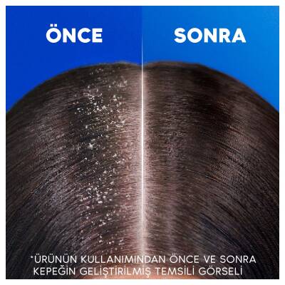 Head & Shoulders Sampuan Supreme Purıfyıng 300Ml - 8